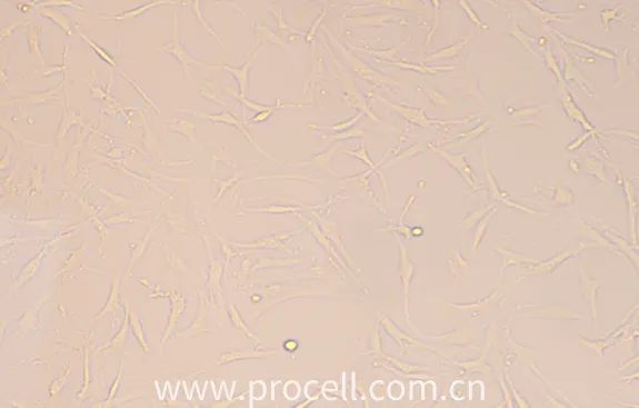 第2代人軟骨細(xì)胞狀態(tài)圖