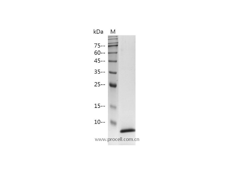 EGF/Urogastrone/URG, Human, Recombinant