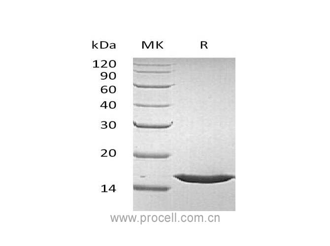 FGF-1/ FGFa/ FGF-acidic (Phe16-Asp155), Human, Recombinant