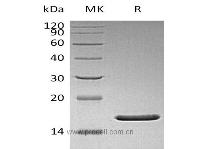 FGF-2/ bFGF/ FGF-b (Q65I, C96S, N111G), Human, Recombinant