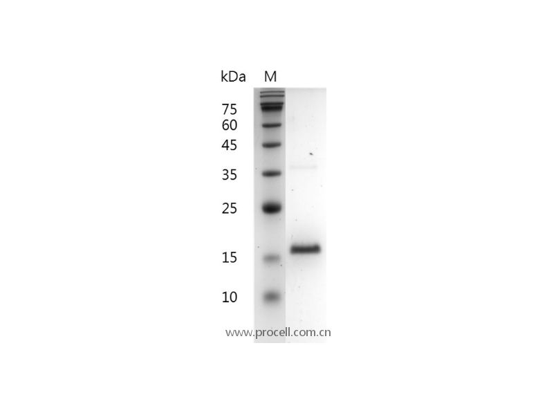 FGF-2/HBGF-2/Prostatropin, Human, Recombinant