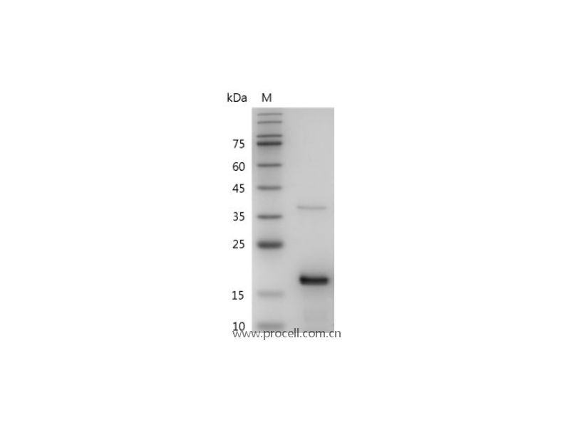 FGF-2/HBGF-2/Prostatropin, Mouse, Recombinant