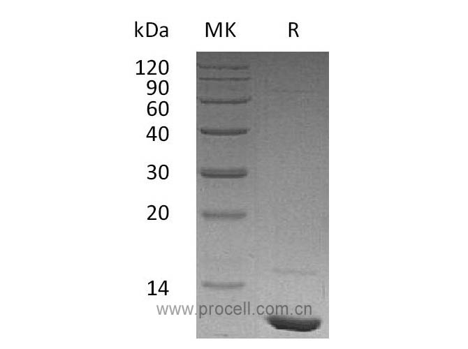 IGF-I/ IGF1/ MGF, Human, Recombinant