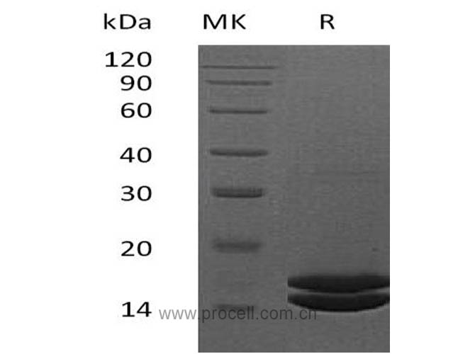 IL-2 (C-6His), Human, Recombinant