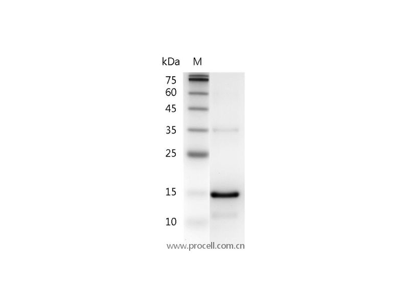 IL-21/Za11, Human, Recombinant