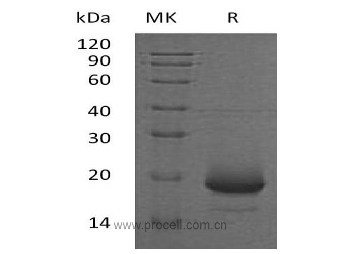 IL-4/ BSF-1 (C-6His), Human, Recombinant