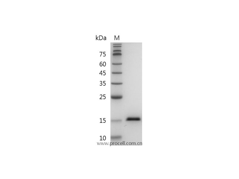 TNF-α/TNFA/TNFSF2, Human, Recombinant