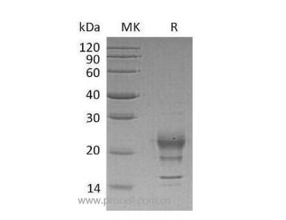 Procell-Interferon γ/ IFN-γ/ IFNG, Human, Recombinant