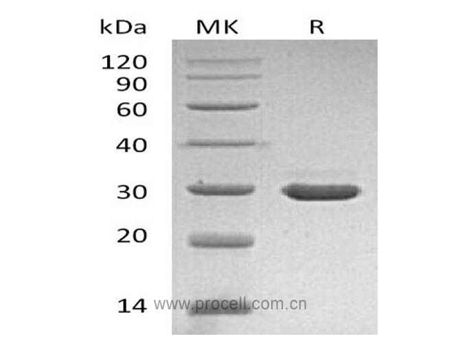 β-NGF/ NGF/ NGFB (Glu19-Ala241), Human, Recombinant