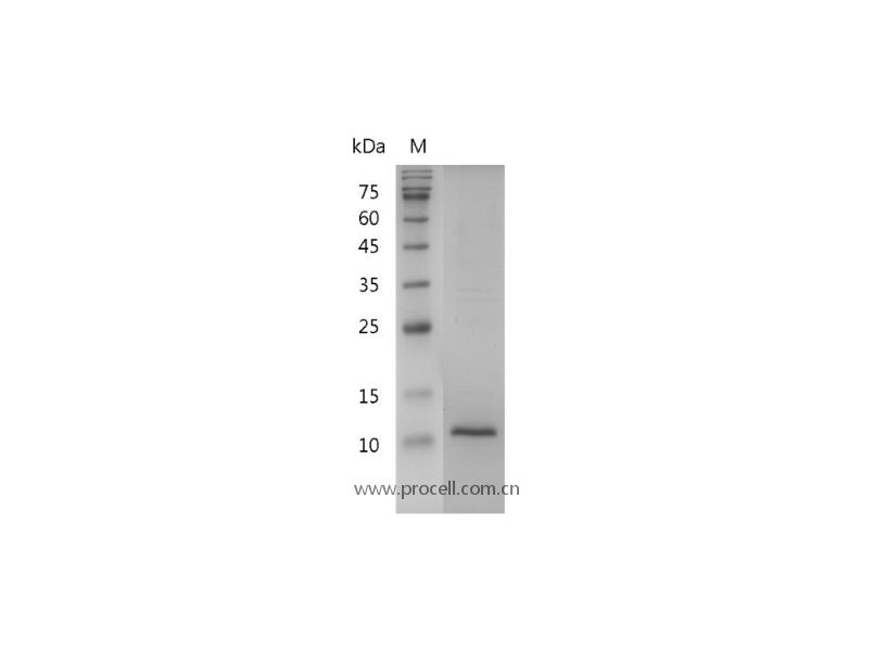 β-NGF/NGF/NGFB/NGF-β, Human, Recombinant