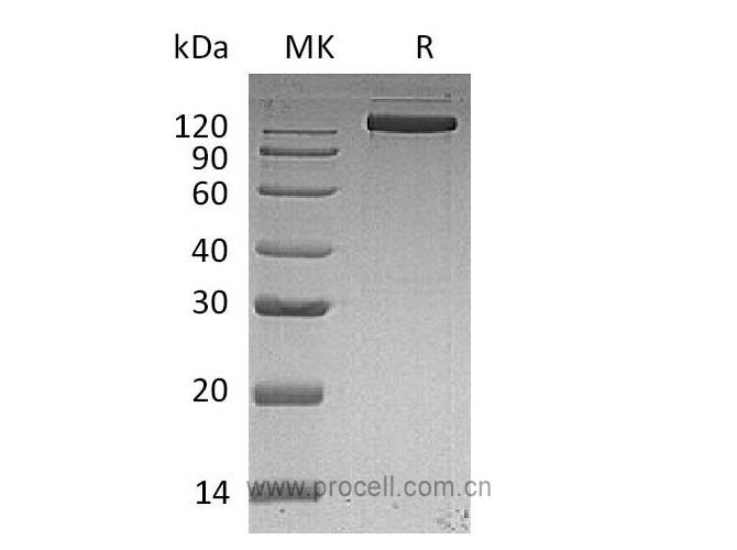 EGFR/ ErbB1/ HER1 (C-Fc), Human, Recombinant