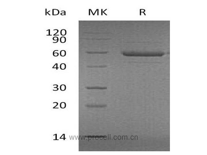 APRIL/ TNFSF13/ TRDL-1α (N-Flag-His), Human, Recombinant