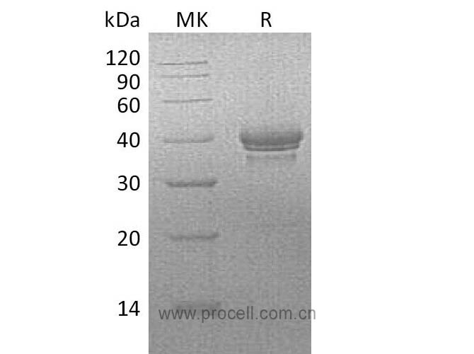 BCMA/ TNFRSF17 (C-Fc), Human, Recombinant