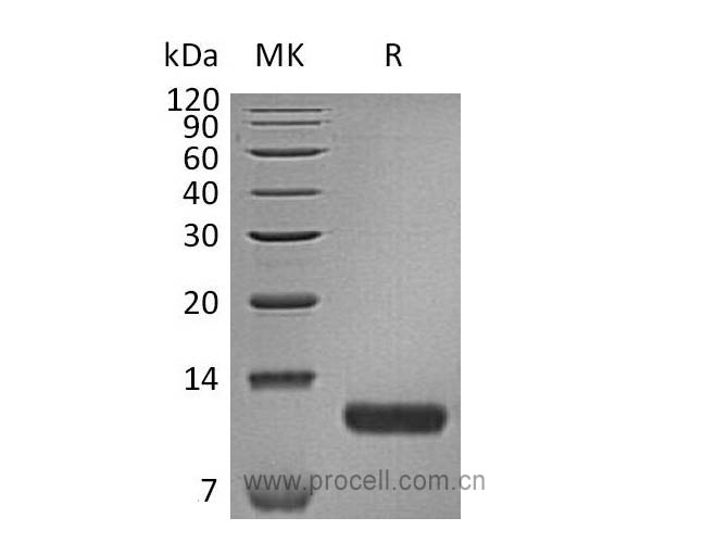 Procell-TARC/ CCL17 (C-6His), Human, Recombinant