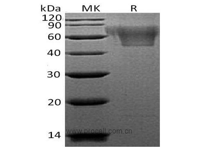 Procell-Fractalkine/ CX3CL1 (C-6His), Human, Recombinant