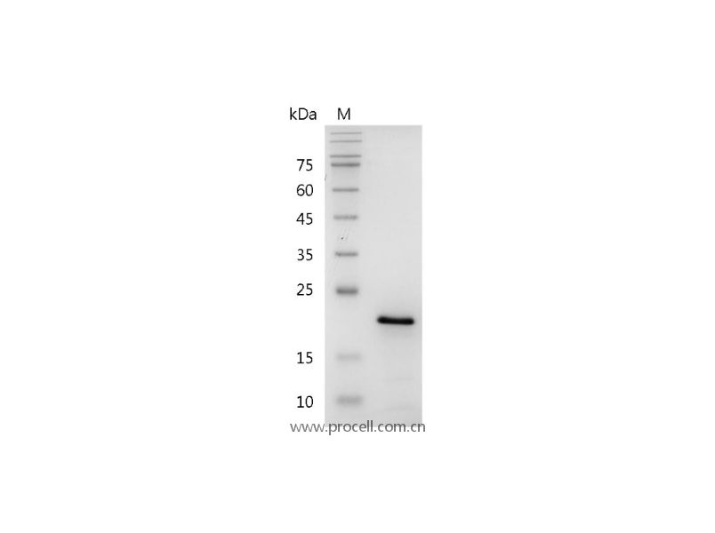 FGF-10/FGFA/KGF2, Human, Recombinant