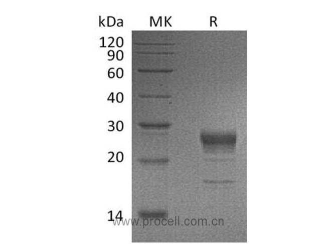 Procell-FGF-7/ KGF (C-6His), Human, Recombinant