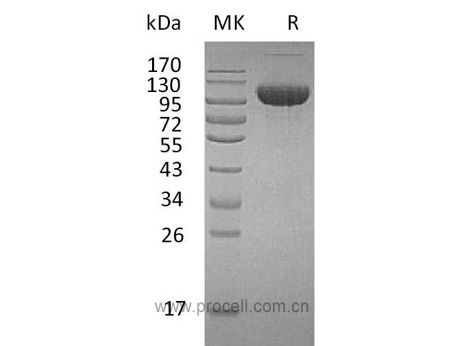 FGFR-3/ CD333/ FGFR3 (C-Fc), Human, Recombinant