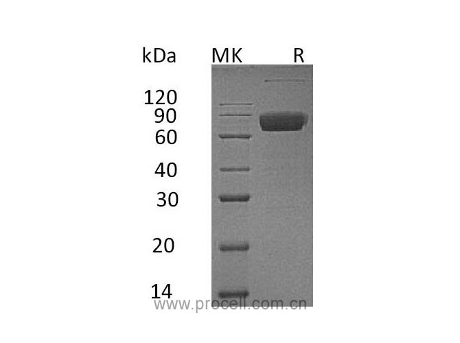 IL-10RB (C-Fc), Human, Recombinant