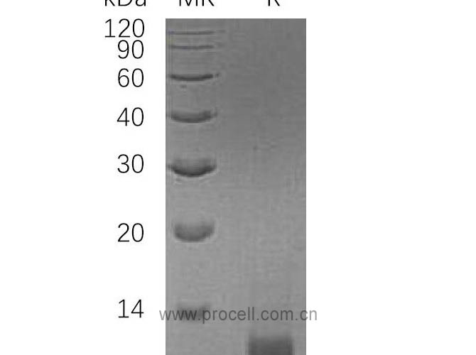 IGF-II/ IGF2, Human, Recombinant