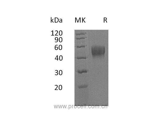 IL-10RB/ IL-10R2, Human, Recombinant