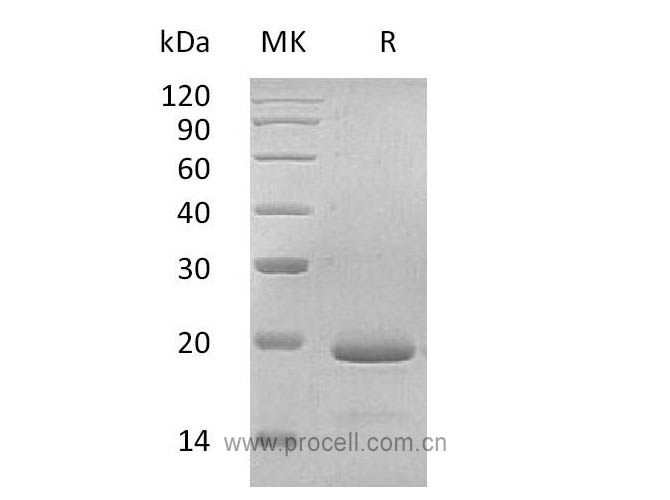 IL-11/ AGIF, Human, Recombinant