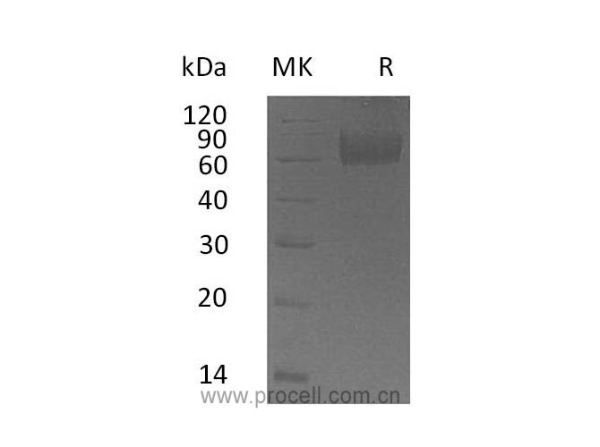 IL-18BP (C-Fc), Human, Recombinant