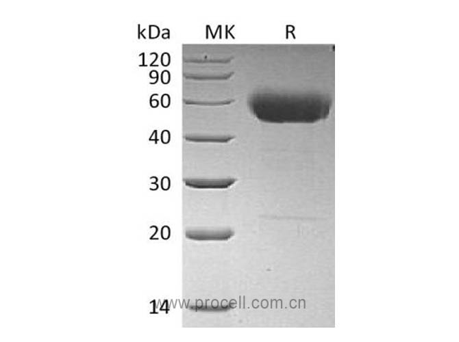 IL-22 (C-hIgG2 Fc), Human, Recombinant