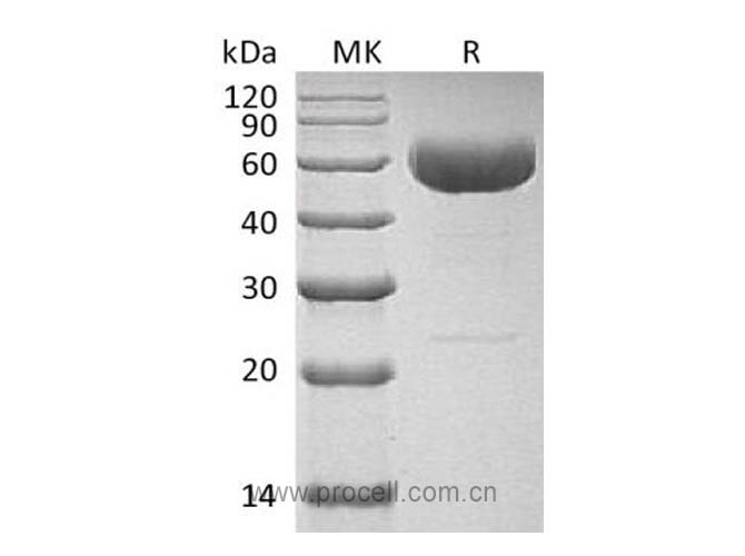 Procell-IL-22 (C-hIgG4 Fc), Human, Recombinant