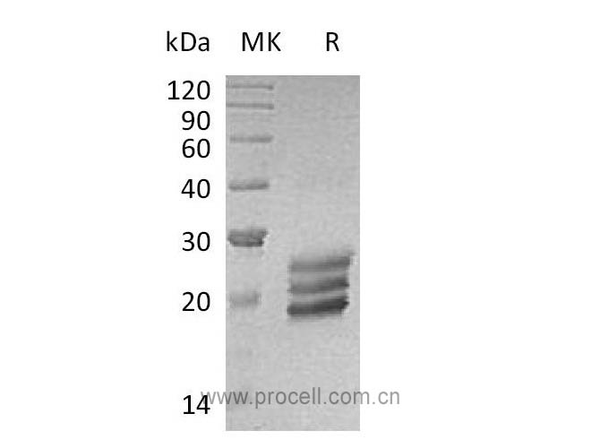 IL-25 (C-6His), Human, Recombinant