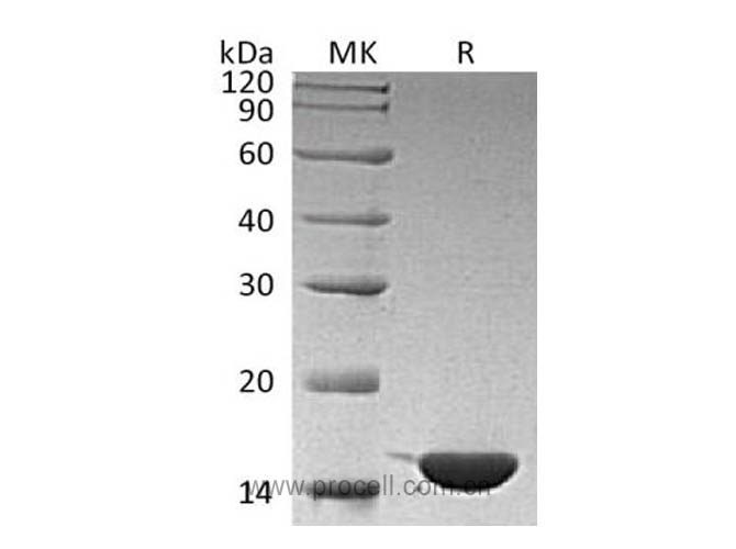 IL-36γ/ IL-1F9, Human, Recombinant