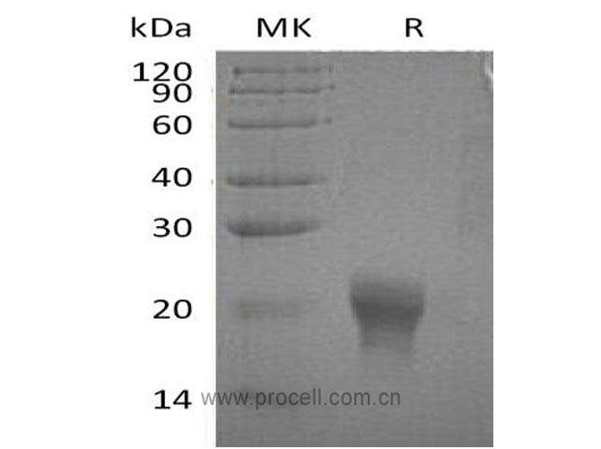 IL-5 (C-6His), Human, Recombinant