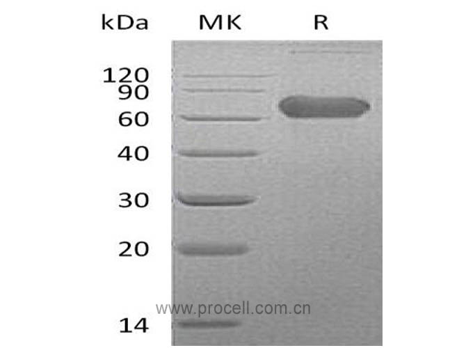 Procell-LTBR/ TNFRSF3/ TNFR3 (C-Fc), Human, Recombinant