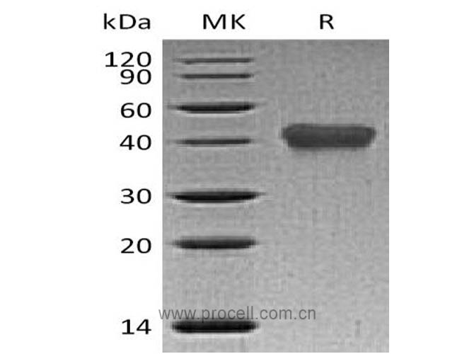 Procell-TNFR2/ TNFRSF1B/ CD120b (C-6His), Human, Recombinant