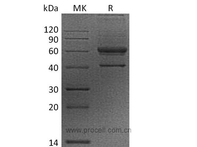 Procell-VEGFB (N-Fc), Human, Recombinant