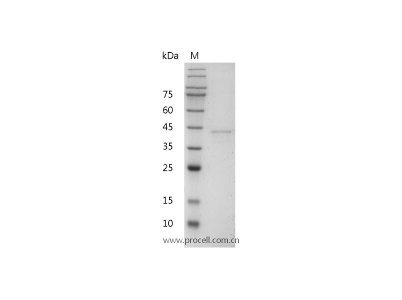 IL-12 p40/IL-12B/CLMF p40,Mouse,Recombinant