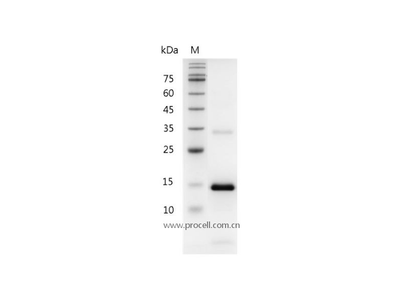 IL-21/Za11, Mouse, Recombinant