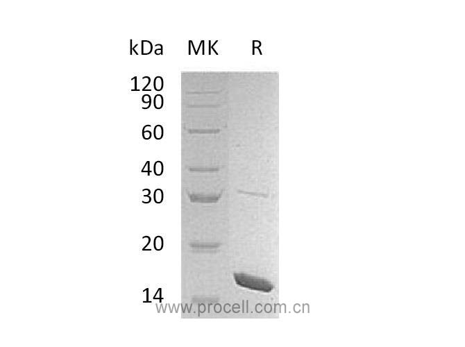 IL-36β/ IL-36b/ IL-1F8, Mouse, Recombinant