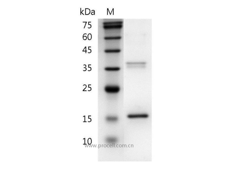 IL-26/AK155, Human, Recombinant