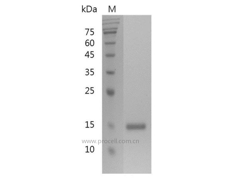 Galectin-1/LGALS1, Human, Recombinant