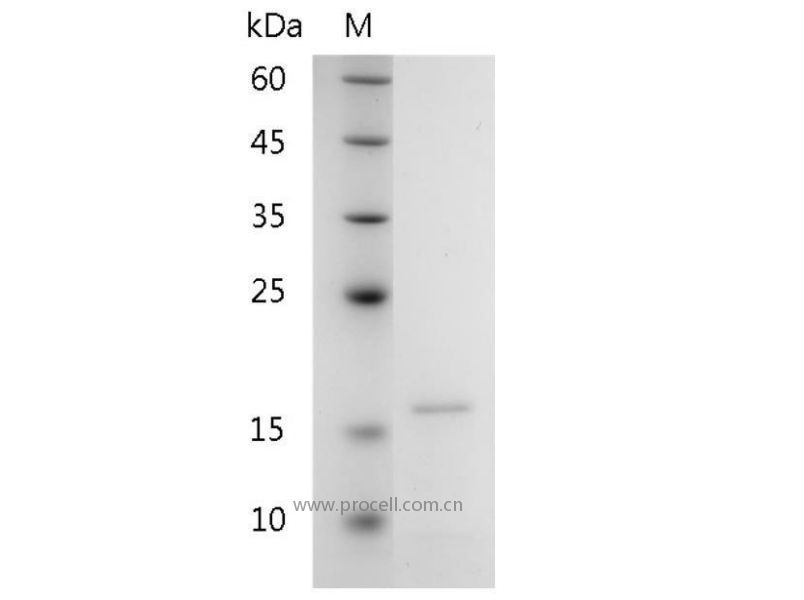 Galectin-10/Gal-10/LGALS10, Human, Recombinant