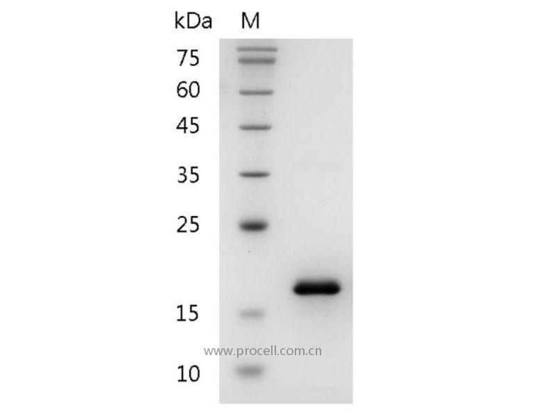 CCL2/MCP-1, Mouse, Recombinant