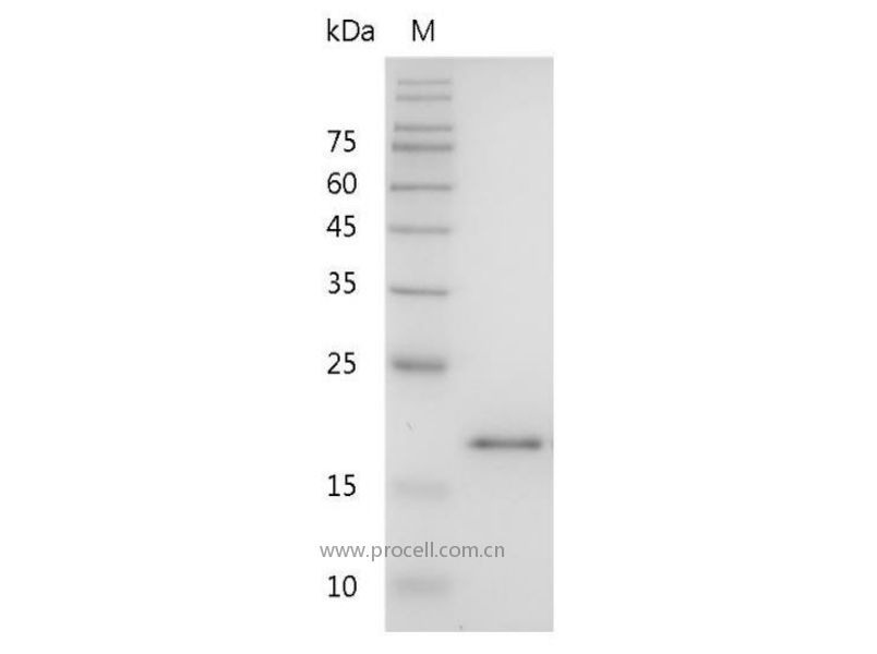 IL-36RA/IL-1F5/IL-1HY1/IL-1δ, Mouse, Recombinant