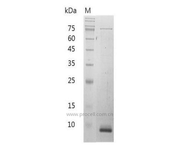 CXCL11/I-TAC/B-R1, Mouse, Recombinant