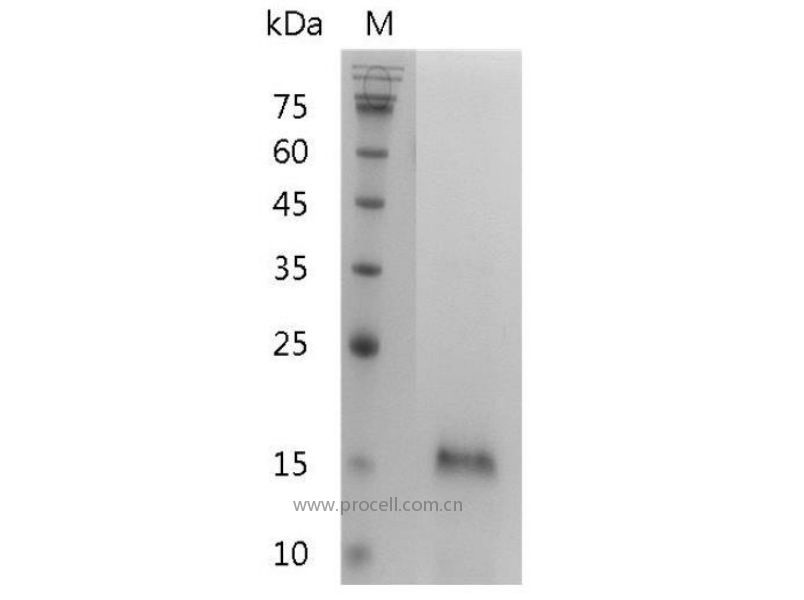 IL-25/IL-17E/Il17e, Mouse, Recombinant