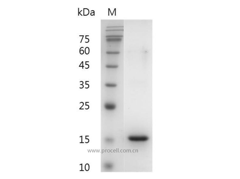 Flt-3 Ligand/FL/FLG3L/FLT3L, Human, Recombinant