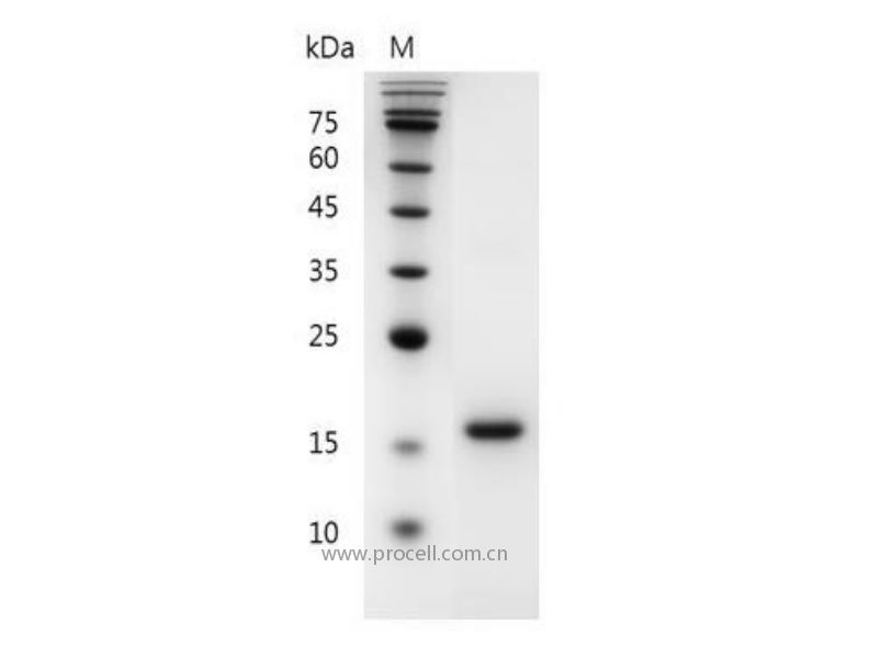 Flt-3 Ligand/FL/FLG3L/FLT3L, Mouse, Recombinant