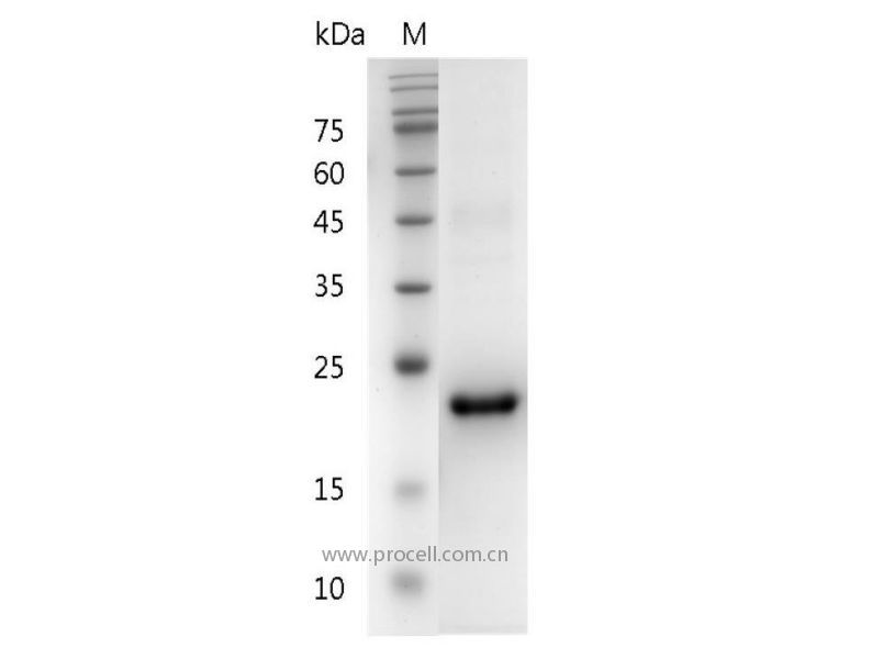 IL-29/IFN-λ1, Human, Recombinant