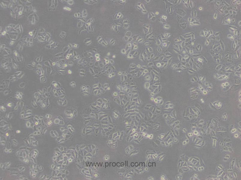 Acc-2 (人涎腺腺樣囊性癌細(xì)胞) (Hela污染細(xì)胞系，暫不供應(yīng))