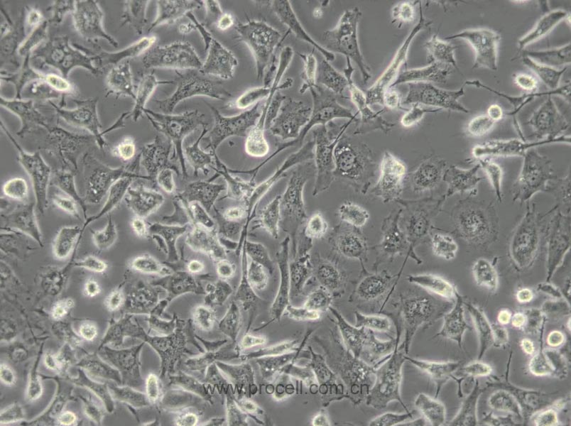 BT-549 (人乳腺管癌細胞) (STR鑒定正確)